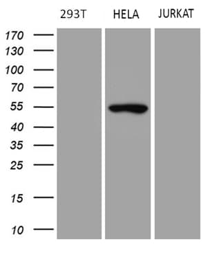 TRIP13 Antibody (aa31-148, clone OTI2F5, Carrier-free)
