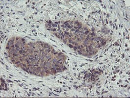 ZNF365 Antibody (clone OTI1B7)