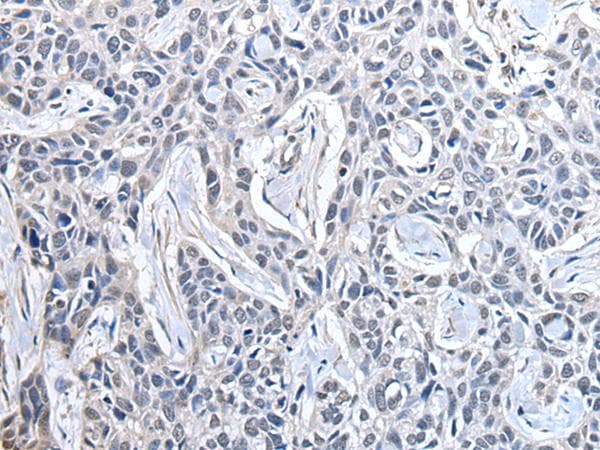 Polyclonal Rabbit anti-Human PPIG / Cyclophilin G Antibody (IHC)