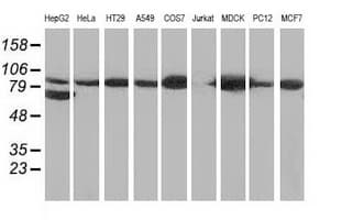 CTNNB1 / Beta Catenin Antibody (clone OTI9H2, Carrier-free)
