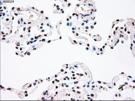 PLK1 / PLK-1 Antibody (clone OTI1D4)