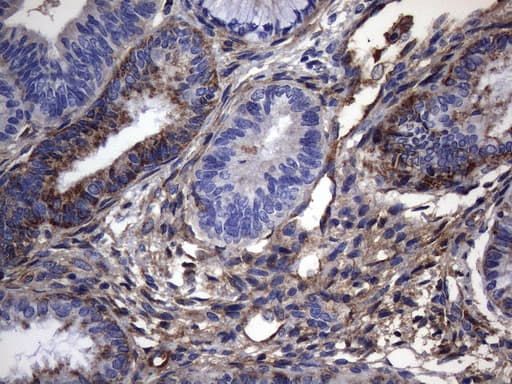 CRP / C-Reactive Protein Antibody (clone OTI1G10)