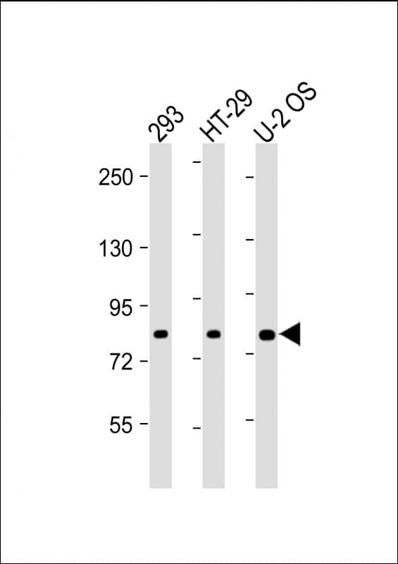 ADD1 / Adducin Alpha Antibody (Internal)