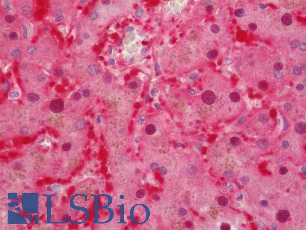 Aspartate Aminotransferase Antibody (Biotin)