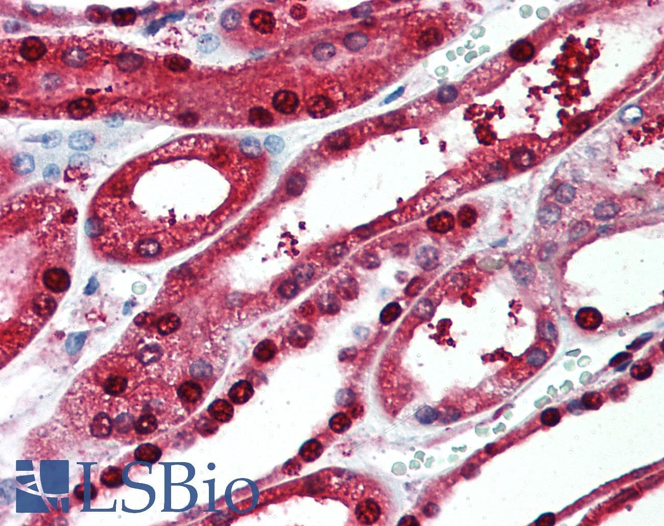 IHC-plus™ Polyclonal Rabbit anti-Human PIGR Antibody (Cytoplasmic Domain, IHC)