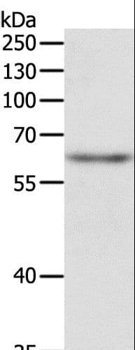 Polyclonal Rabbit anti-Human TRAF3IP2 / ACT1 Antibody (IHC, WB)
