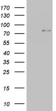 POSTN / Periostin Antibody (aa538-781, clone OTI2F7)