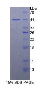 Rat NPHS1 / Nephrin Protein (Recombinant His-GST)