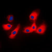 CYP2A6 Antibody (N-Terminus)