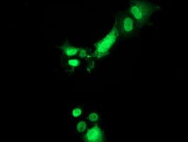 PYCRL Antibody (clone OTI8H6)