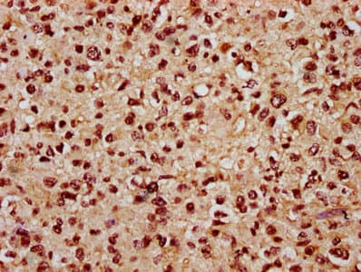 Polyclonal Rabbit anti-Human LIN9 Antibody (IHC)