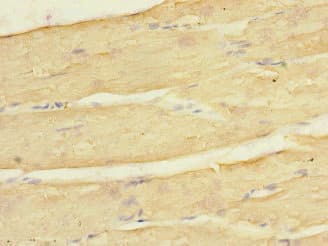 KCNJ4 / Kir2.3 Antibody