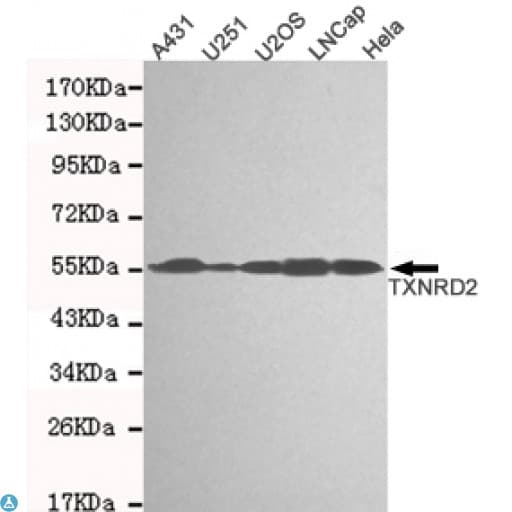 Monoclonal Mouse anti-Human TXNRD2 Antibody (WB)