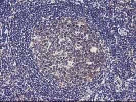 TIMP2 Antibody (clone OTI1B11, Carrier-free)