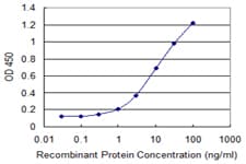 GNT-V / MGAT5 Antibody (clone 3E9)