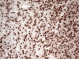 Monoclonal Mouse anti-Human NUMB Antibody (clone OTI2F1, aa1-365, IHC, WB)