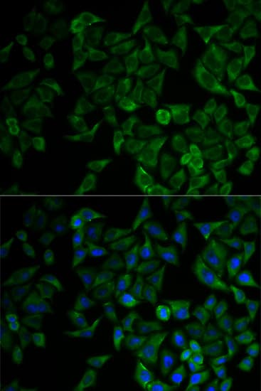 Polyclonal Rabbit anti-Human TNFRSF1A / TNFR1 Antibody (IHC, IF, WB)