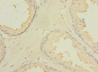 CXorf21 Antibody (aa1-301)