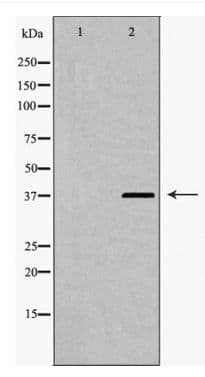 HNRNPD / AUF1 Antibody (phospho-Ser83)