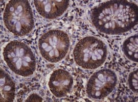 HSPD1 / HSP60 Antibody (clone OTI3G10)