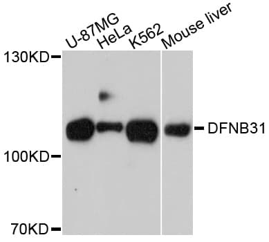 Polyclonal Rabbit anti-Human WHRN Antibody (WB)