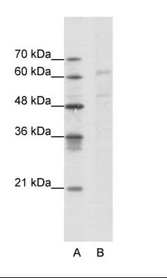 Polyclonal Rabbit anti-Human CACNB3 / Cavbeta3 Antibody (aa391-440, WB)