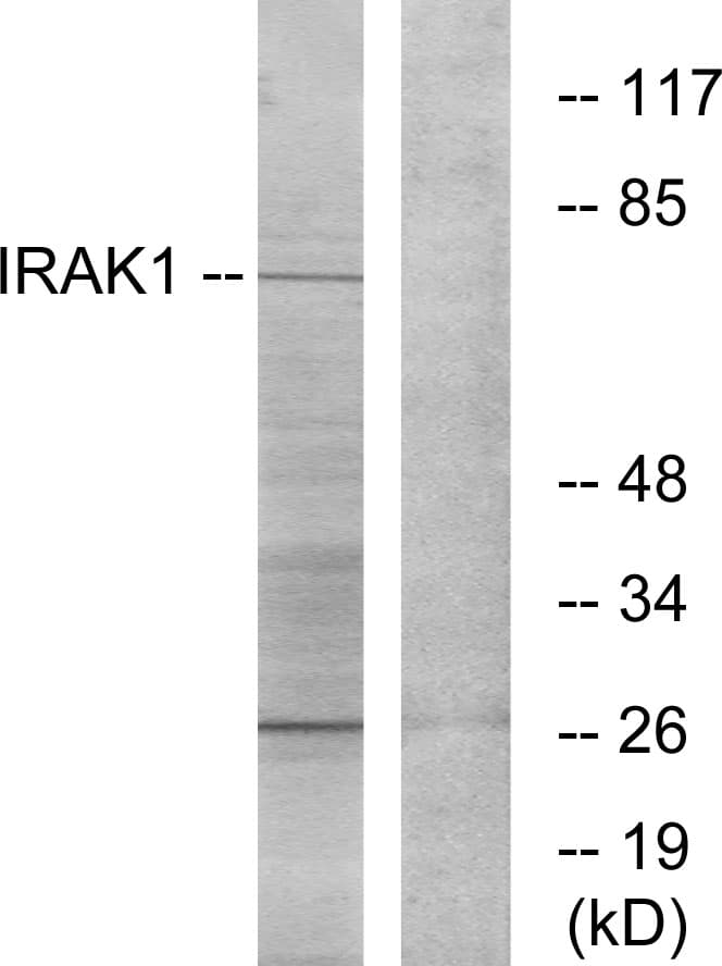 IHC-plus™ IRAK1 / IRAK Antibody (aa175-224)