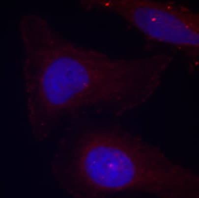 Polyclonal Rabbit anti-Human PTK2B / PYK2 Antibody (phospho-Tyr402, IHC, IF, WB)