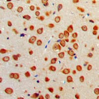 NTN1 / Netrin 1 Antibody (C-Terminus)