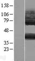 P2RY14 / GPR105 Protein (Over-Expression Lysate Myc-DDK (Flag))
