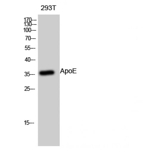 APOE / Apolipoprotein E Antibody (Internal)