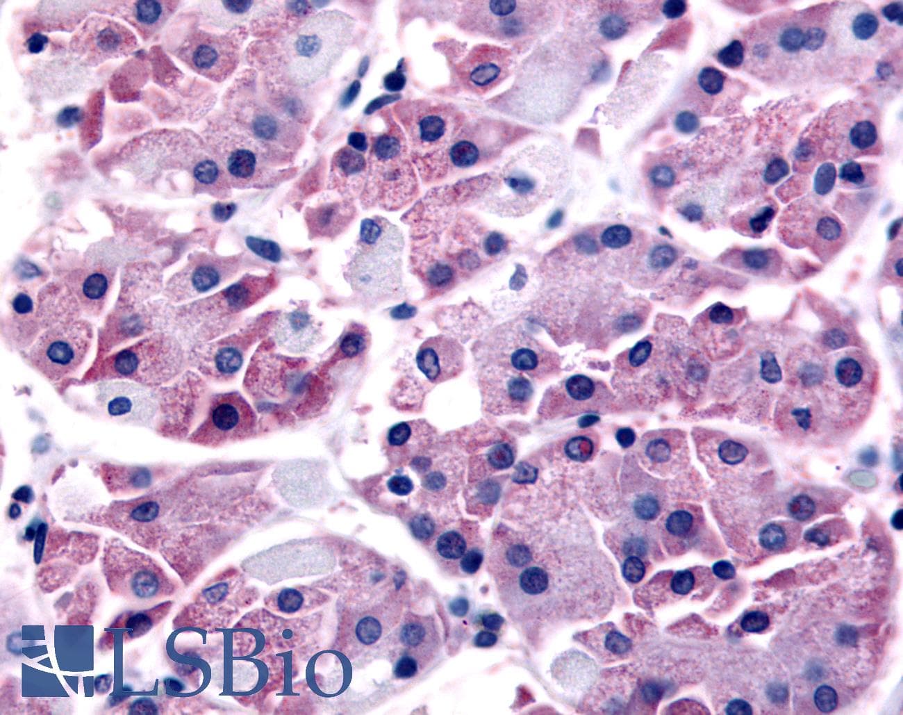 PathPlus™ SLC7A11 / XCT Antibody (N-Terminus)