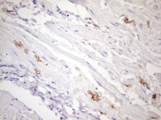 FBP / FOLR2 Antibody (aa20-221, clone OTI4G6)