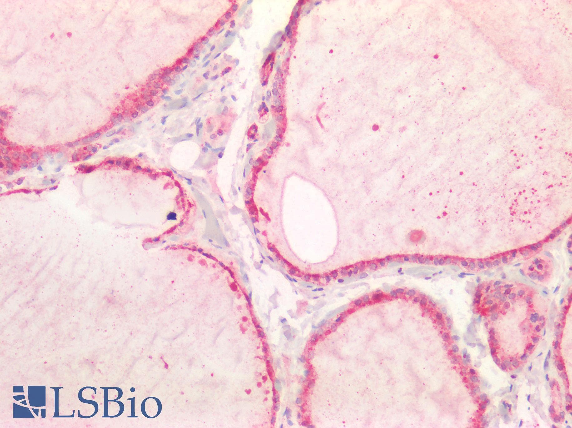 IHC-plus™ CTSB / Cathepsin B Antibody