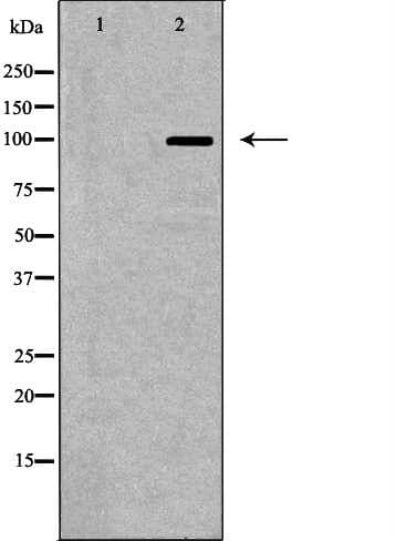 GRIK2 / GLUR6 Antibody