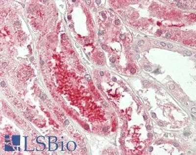 IHC-plus™ PLEKHJ1 Antibody (aa1-147)