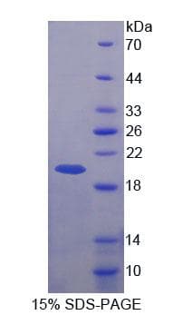 Human BRCC3 / BRCC36 Protein (Recombinant His-T7)