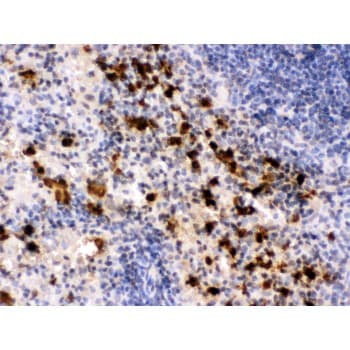 S100A9 / MRP14 Antibody (aa2-113)