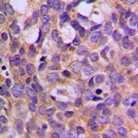 Polyclonal Rabbit anti-Human RPS6KB1 / P70S6K / S6K Antibody (phospho-Thr444, IHC, IF, WB)