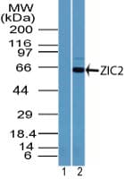 Polyclonal Rabbit anti-Human ZIC2 Antibody (aa350-400, WB)
