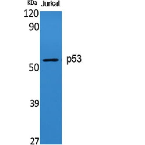 TP53 / p53 Antibody (10-90 aa)