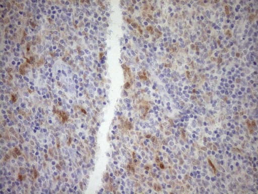 p16INK4a / CDKN2A Antibody (clone OTI7B10)