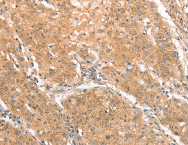 CXCR4 Antibody