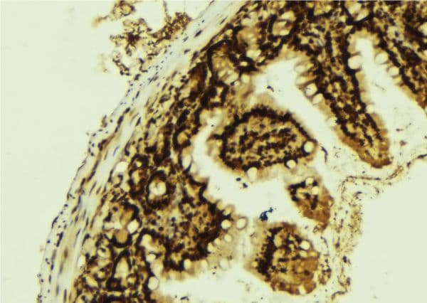 Polyclonal Rabbit anti-Human EGFR Antibody (phospho-Tyr1016, IHC, IF, WB)