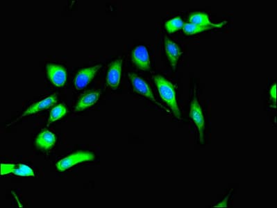 Polyclonal Rabbit anti-Human RPS6KA4 / MSK2 / RSK-B Antibody (IF, WB)