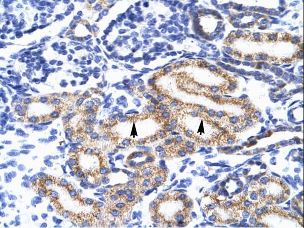 Polyclonal Rabbit anti-Human MEIS2 Antibody (aa50-99, IHC, WB)