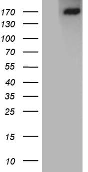 ACE / CD143 Antibody (aa642-1230, clone OTI2G5)