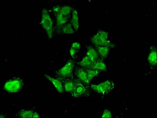RPS6KA1 / RSK1 Antibody
