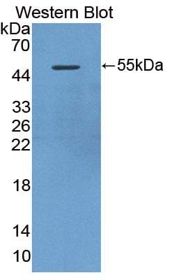 DAPK3 / ZIP Kinase Antibody (aa1-448)