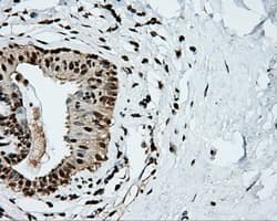 Monoclonal Mouse anti-Human TLDC1 / KIAA1609 Antibody (clone OTI5D9, IHC, IF, WB)